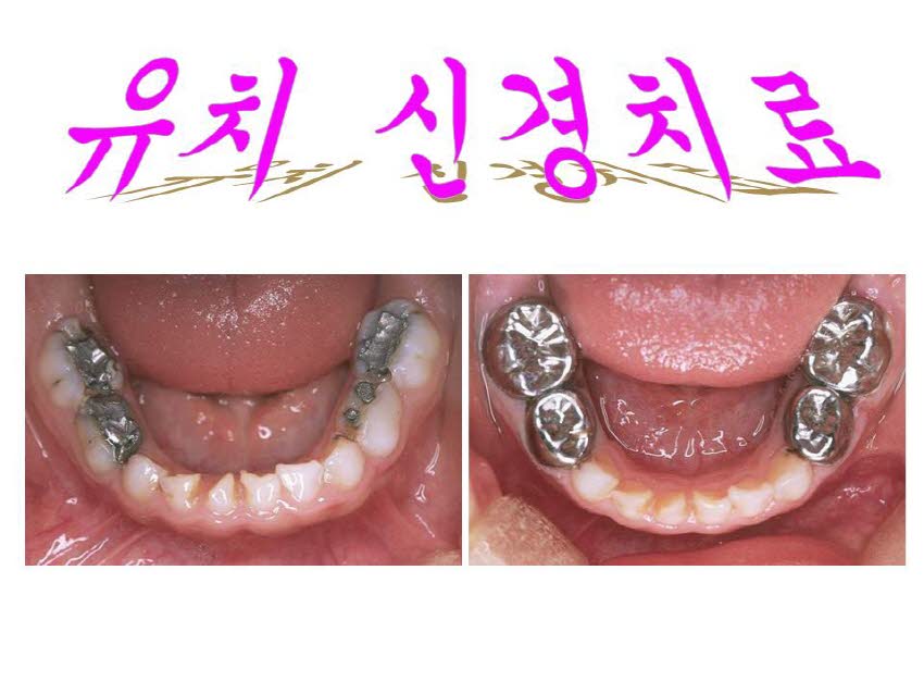 상담자료소아 첨부파일 : 1206889200_189.jpg